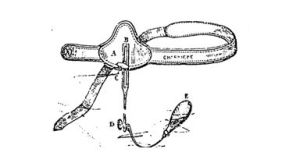 Histeroforo de Becquerel