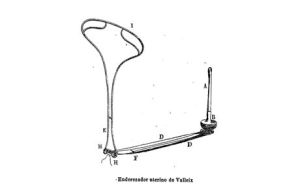 Histeroforo de Valleix