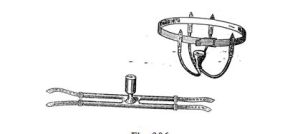 Histeroforo de Breslau