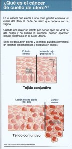 Cancer de cuello 001 - copia