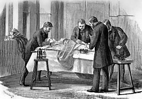 Pulverizador de Lister