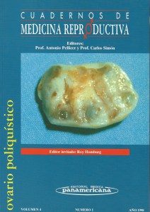 Ovario poliquistico 001