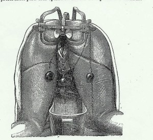 posicion-ginecologica