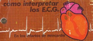 Como interpertrar los ECG
