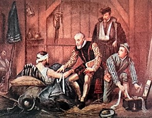 Ambroise Pare operando