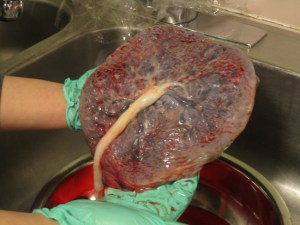 Placenta