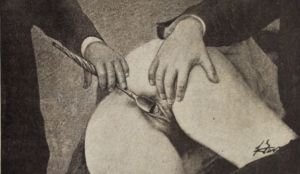 Exploración con espéculo de Sims